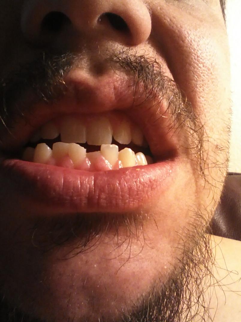 toof.jpg